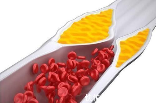 身体|50岁是长寿的关键期，这4处没有“变硬”，值得恭喜，身体还不错