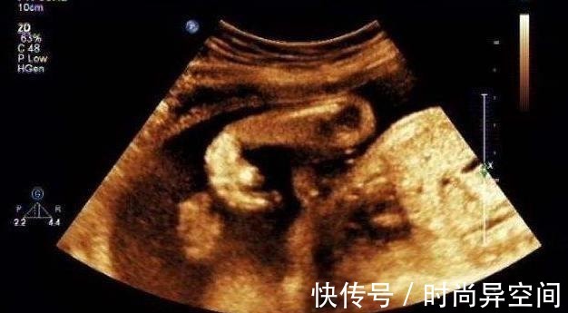 农村|农村孕妇医院产子,医生看到婴儿连连后退,家人无法接受!