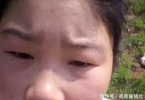 习惯|令眼睛“变小”的3习惯,98%的人都踩雷,小心变“一线天”!