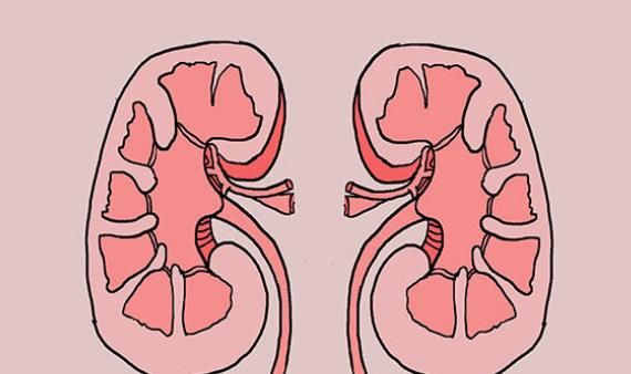 高血压是如何拖成尿毒症的？此动脉可堵不得，