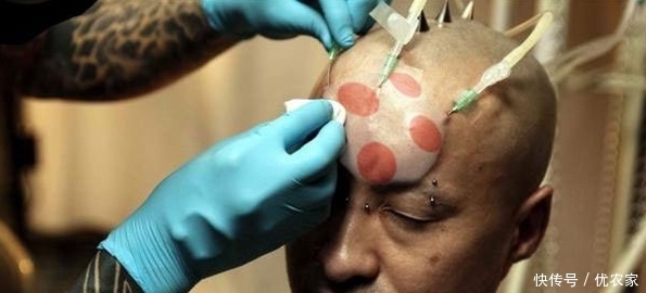 现实版的”脑子进水”,日本人流行的整形方式,我们读不懂的时尚