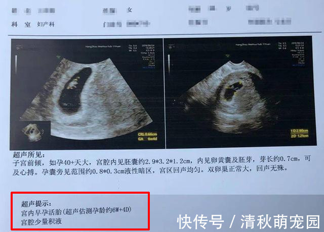 阴超|怀孕多久做B超检查比较好?这份孕早期检查攻略,孕妈们查收学习