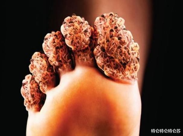 尿酸偏高的人，建议少吃1类食物，常喝“1茶”，或助尿酸值平稳