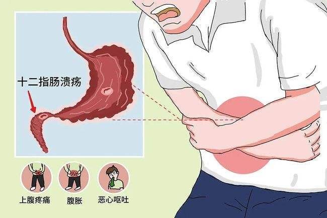 icu|锦旗背后的故事：患者上消化道穿孔病情危急，医护团队齐心协力暖心救治