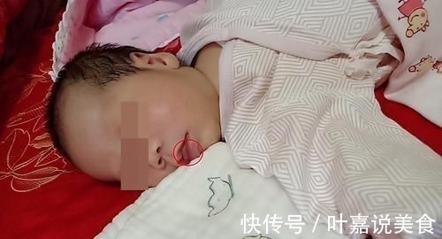 父母|五个月女婴双肾长满结石,只因刚出生三天,父母就开始做这件事