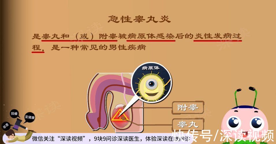 蛋蛋|蛋蛋又痛又肿还发烧？小伙长期熬夜突发睾丸炎？这些症状要小心