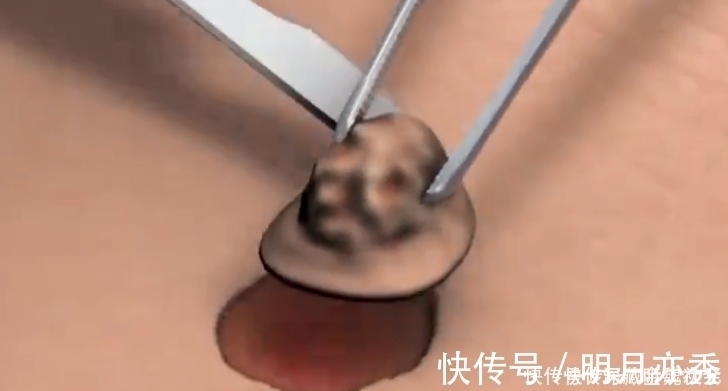 格罗布奥特曼|格罗布奥特曼如何融合?泽塔奥特曼dx勋章玩具