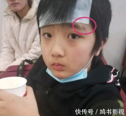 正臉|錄《爸爸去哪兒》造成眼角永久性傷害的費曼露,放下心結露正臉