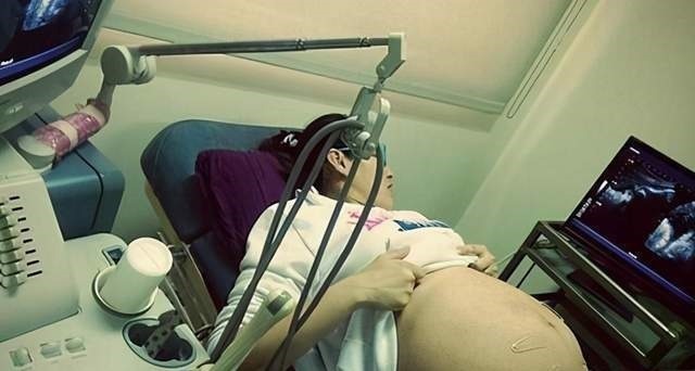 产检|怀孕8个月,产检被告知多条腿,娃生下全家乐了,网友反应很直接