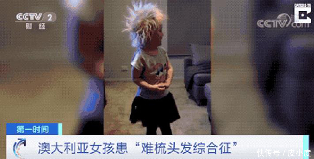 莱拉|为什么有人天生就是“离子烫”?拉都拉不直那种