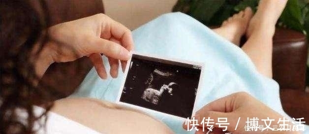 胎儿|孕妇最痛苦的两项产检, 有一项很多孕妈没通过, 整个孕期惶恐不安