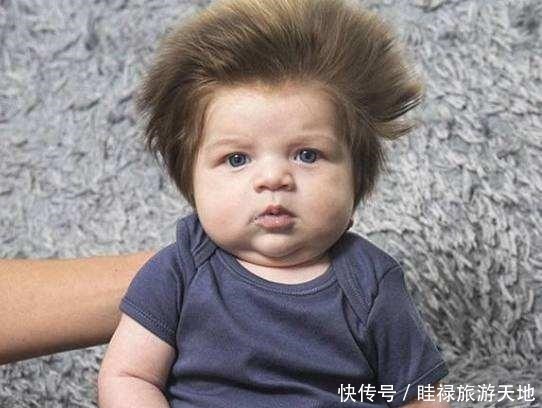 准妈妈|宝宝头发总是“竖着长”可能是营养不足,这3个原因妈妈要分清