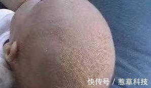 小美|宝妈太爱干净了,出生15天后,她的孩子被送到了医院,医生责备宝妈无知