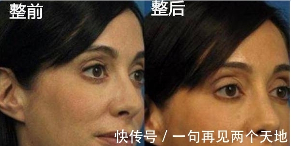 tri女子嫌弃自己拍照不上镜，花费10万元疯狂整容，整容后像20岁