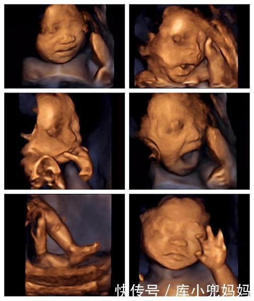 怀胎|十月怀胎要经历各式各样的孕检，最折磨人的孕检是哪项？