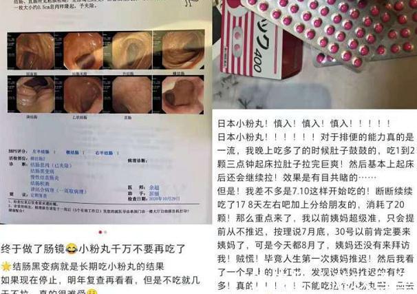 陈梦|27岁学生便秘吃“网红神药”,每天吃100粒还没用,腹内积粪达6斤