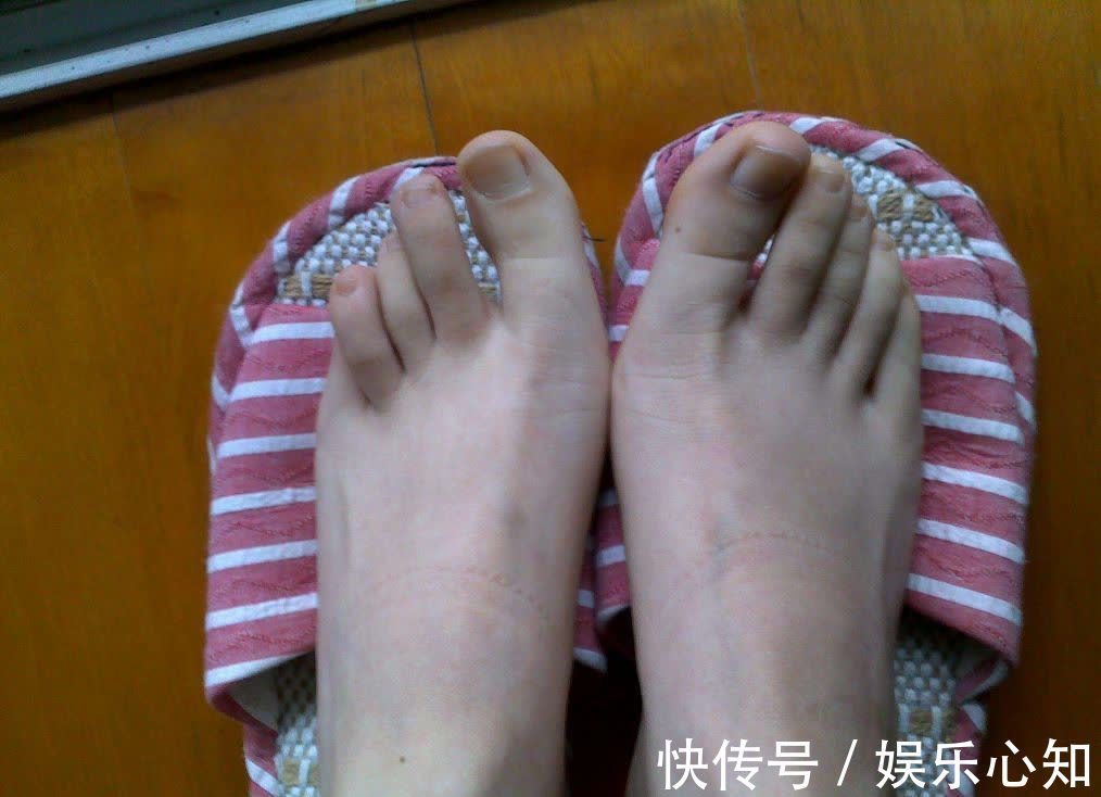 危害|爱穿高跟鞋的女性要小心，长期穿高跟鞋，会给身体带来3个危害