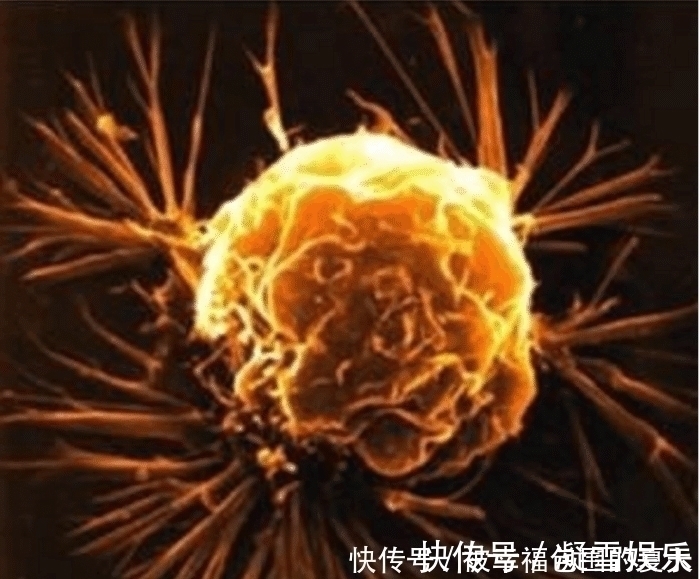 器官|女子死于中风,将器官捐献给5人,结果先后四人不幸中招