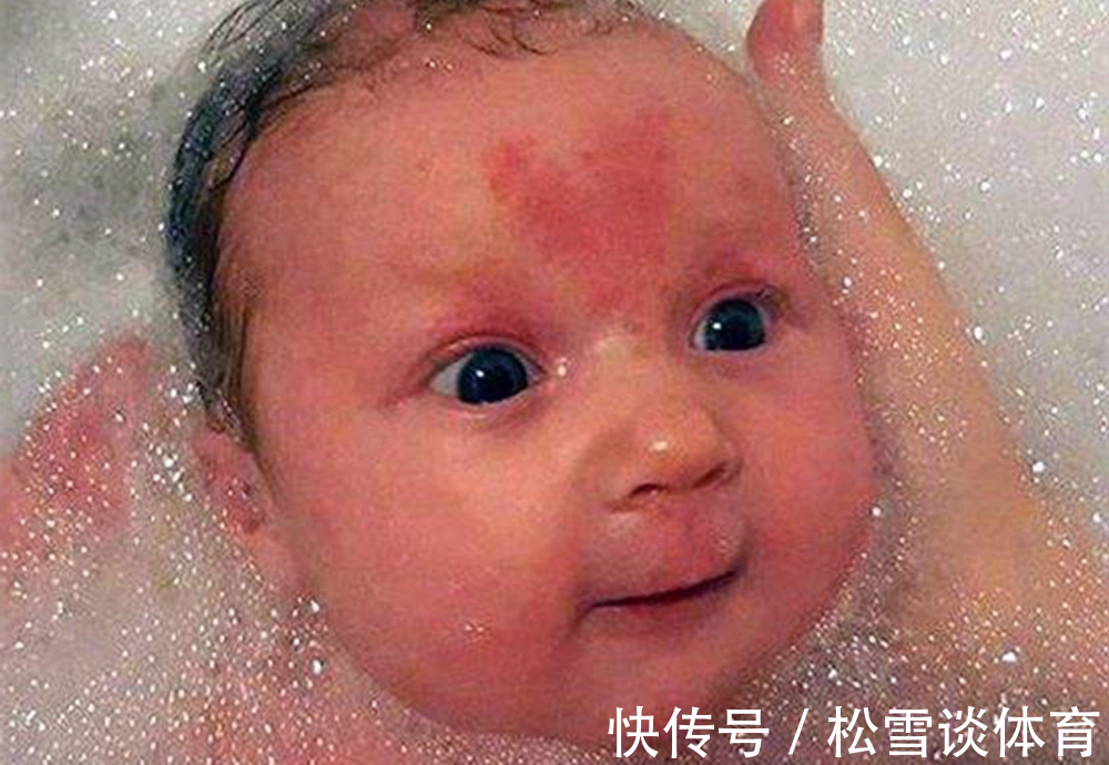 淡青色|孕期别干5件事,不然胎记找上宝宝,不然长大被孩子怨恨