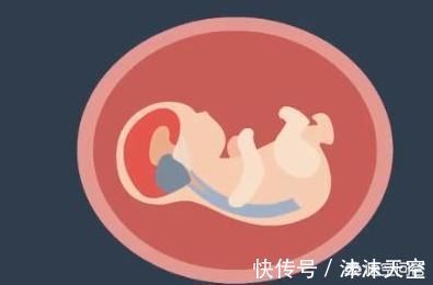 胚胎|为什么怀孕不到3个月,医生还让我做B超检查,有什么意义?