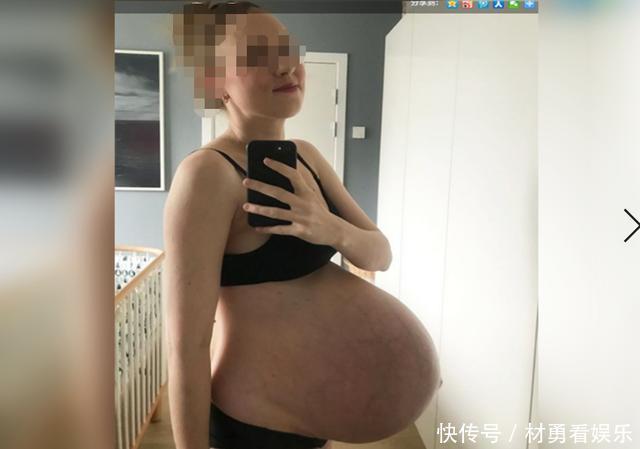 皮肤|孕妈晒“悬浮肚”走红，人人说是双胞胎，孕妈遭遇让人心疼又担心