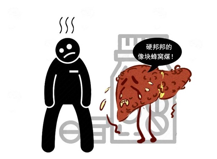 肝性脑病|肝腹水和肝硬化什么关系?出现肝腹水,这些误区别再踏入