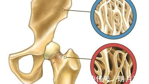 女性朋友|女人过了50岁,这2种食物要舍得吃,或能帮你预防骨质疏松