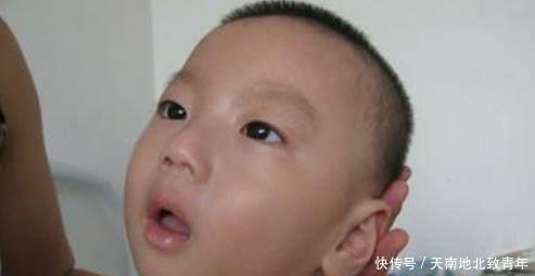 大意|新生儿有这几种表现，可能是患上了脑瘫，做父母的不能大意！