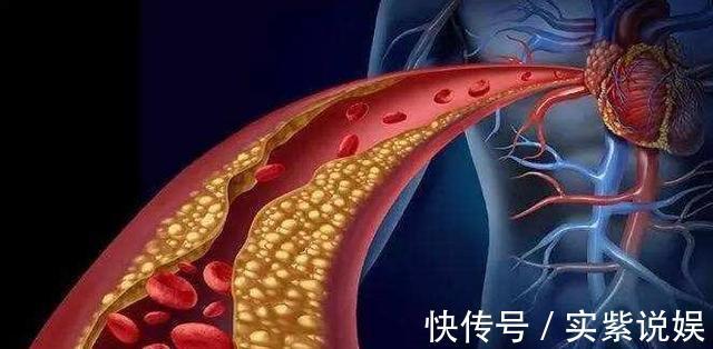 鹌鹑蛋比鸡蛋更有营养吗营养师提醒不管好处,每天都别吃太多