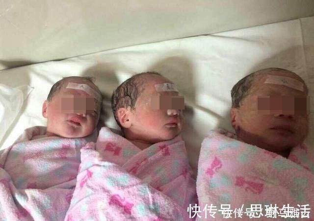 孕妇|生下双胞胎后，产妇却大喊“等一下”，医生检查后，发现意外惊喜