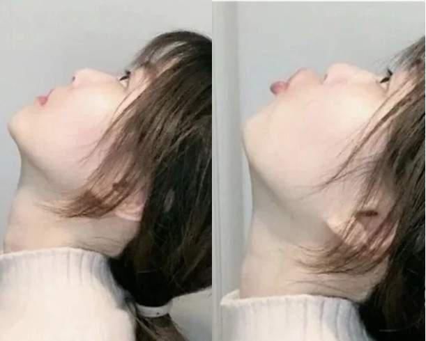 脸胖还有分类型？挑选适合的瘦脸操运动 轻松消除双下巴