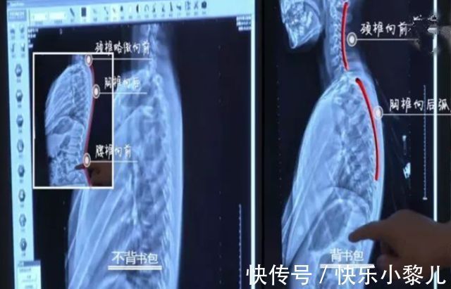 课程表|孩子的书包一定要自己背?“小肩膀、大书包”,他们承受的是什么