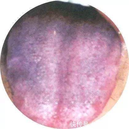 大黄|一个治顽固性胃痛的简易方子！两味药，老中医人的真情奉献