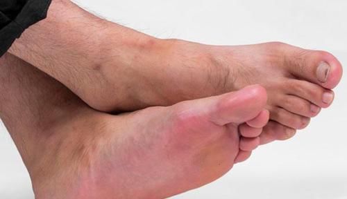 糖菜|血糖稳不稳,看脚上“信号”就知道,不想血糖飙升,可多吃控糖菜