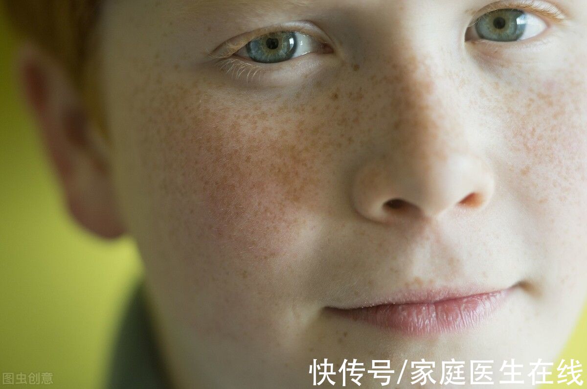 面色|身体不好，看脸就知道？有研究证明的！出现这些表现，该查查了