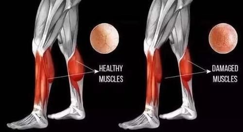 年龄|年龄越大，越要少吃肉？建议50岁后，2种肉不但要吃，还要多吃