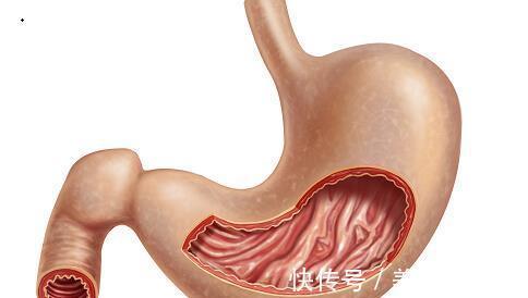 保护伞|胃病少吃胃药,常吃一种食物,做胃的“保护伞”!