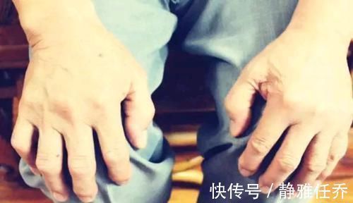 改正|不论男女,40岁后膝关节会出现明显退化,四件事要少做,尽量改正