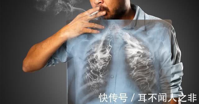 癌变|肺部发生癌变，手上三处“感觉”比较强烈，若全没有肺还很健康