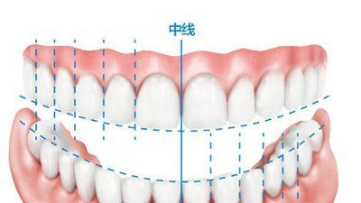 牙齿咬合关系正常的六项标准