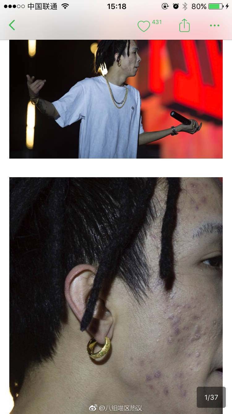 tt被爆ypcf大量未p丑照流出又一位嘻哈歌手要凉