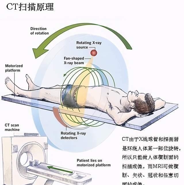 伦琴|做B超前涂的那层黏黏的、凉凉的液体是什么?做完要马上洗掉吗?