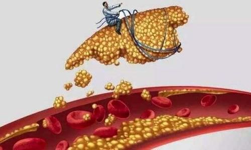 超标|甘油三酯超标,怎么办?菜市场的1种食物常吃,甘油三酯立马正常