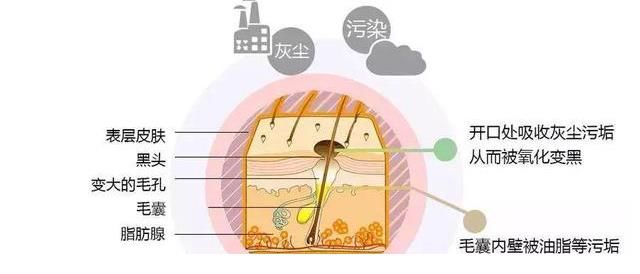 错误|这些去黑头的方法都是错的