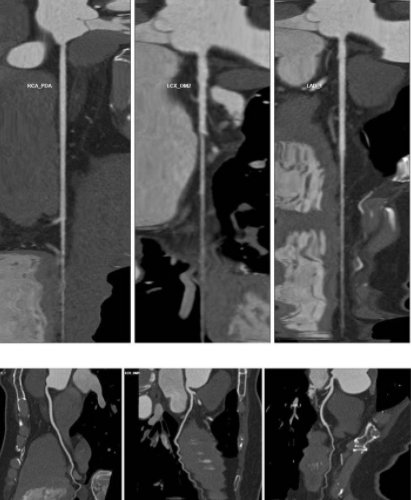 济南南郊医院已成功开展冠状动脉CT强能力，促提升| 冠状动脉