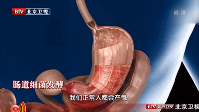 肝气不舒|凌晨1-3点容易醒？是身体2个地方堵了！老中医这样吃，安睡到天亮