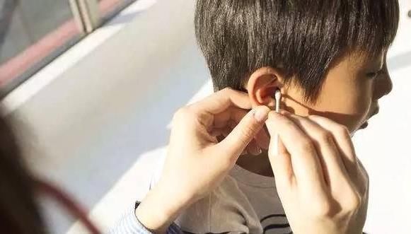 文文|为什么有些孩子耳朵会有“小孔”医生一般不说,父母心里要有数