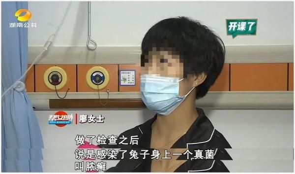 黄癣|多名孩子中招，头皮溃烂脱发，家里养宠物的请注意