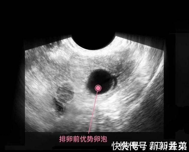 羊水|胎儿从卵泡到性别形成，17张图片清晰诠释，男宝女宝看得很清楚
