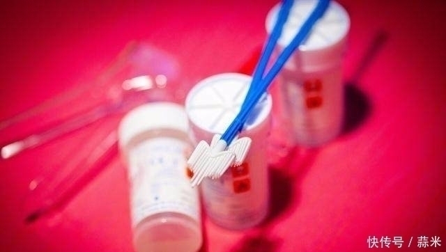 信号|“宫颈癌”来临前，身体一般会发出3个“信号”！